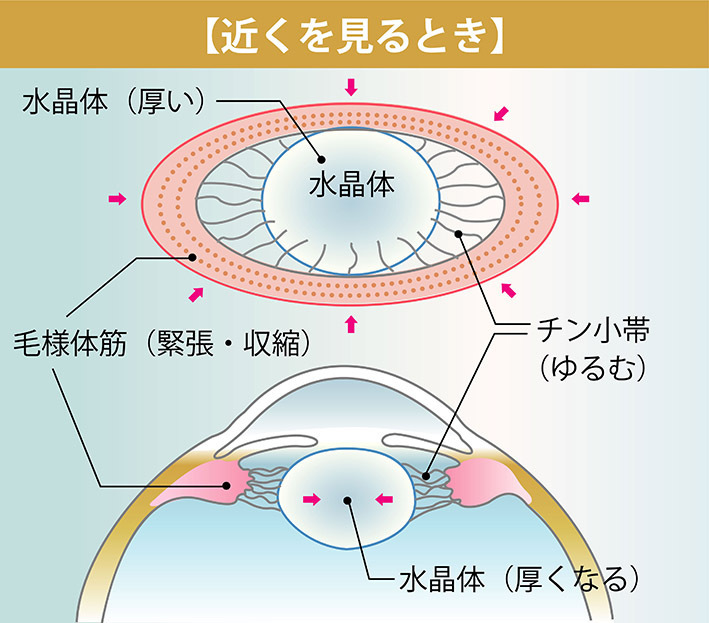 近くのものを見るとき、毛様体筋が収縮して、毛様体の環状の輪が小さくなり、チン小帯がゆるみ、水晶体はそれ自体の弾性で厚くなる。