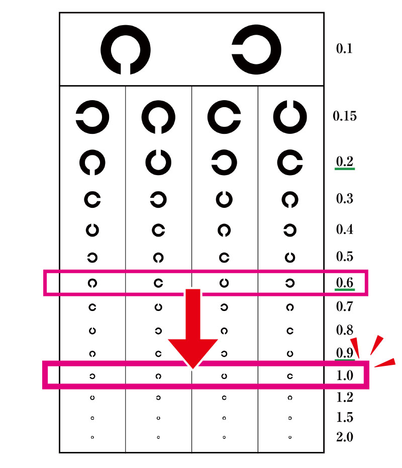 視力検査表でみる視力変化