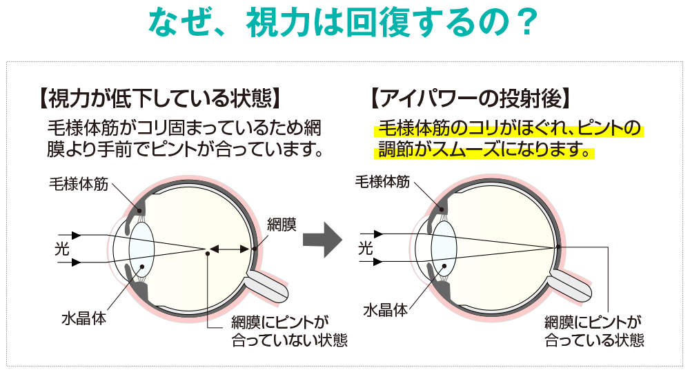 なぜ視力は回復するの？