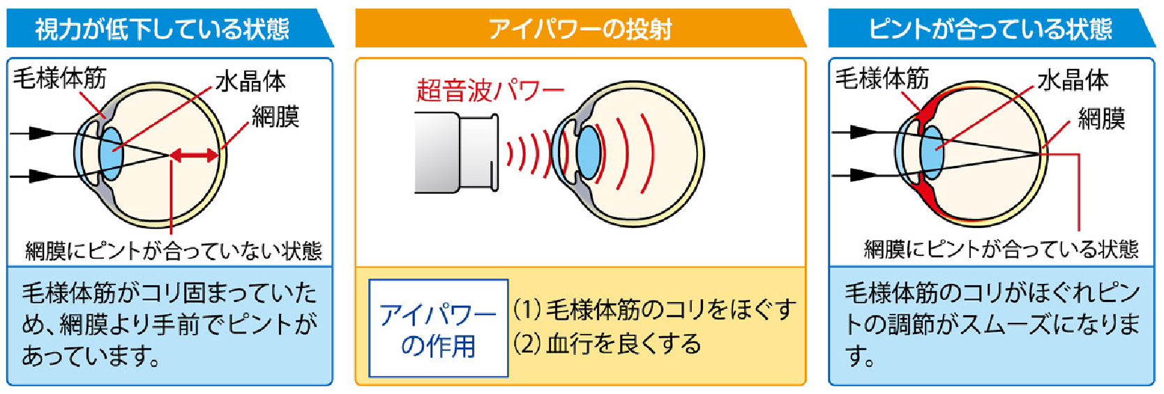 アイパワー