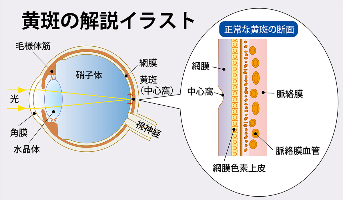 緑内障、糖尿病網膜症、加齢黄斑変性を自己チェックで早期発見!