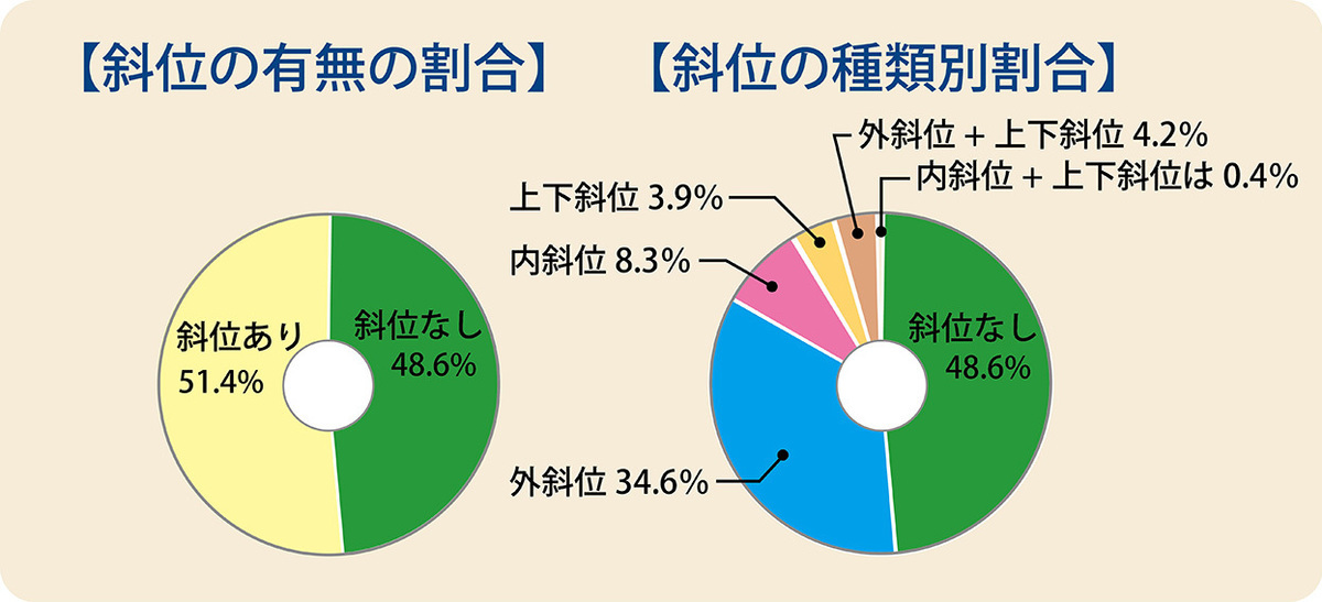 目が疲れる、ものがダブって見える、それは“斜位”のせいかも。