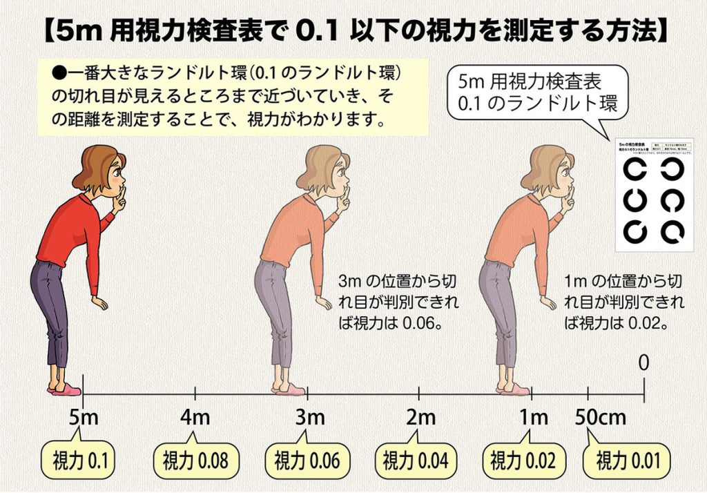 視力検査表の一番上のマークも見えない! どうすればいい?