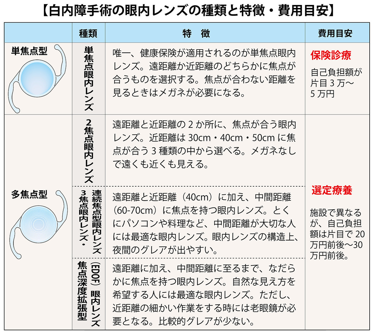 中高年の目の病気 ①　白内障と白内障手術