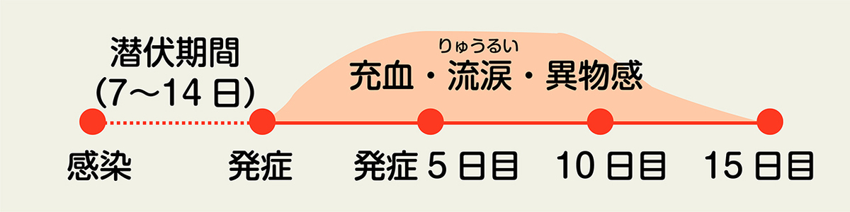 今年は、「はやり目」流行性角結膜炎の流行に要警戒!!