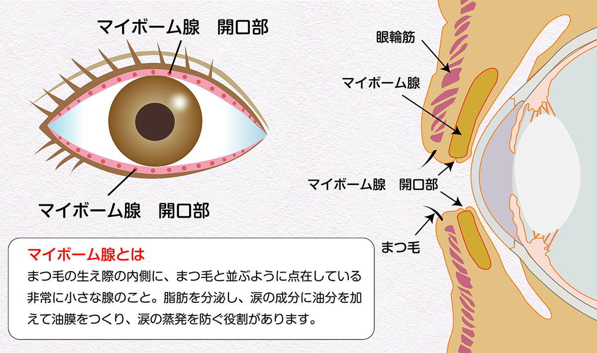 目薬をさしても疲れ目や乾き目が改善しないのは「涙の質」が原因。