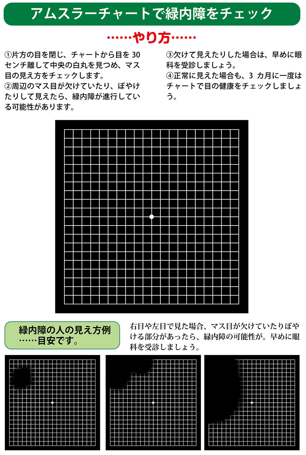 眼圧の上昇で視野が狭まる目の病気【緑内障】