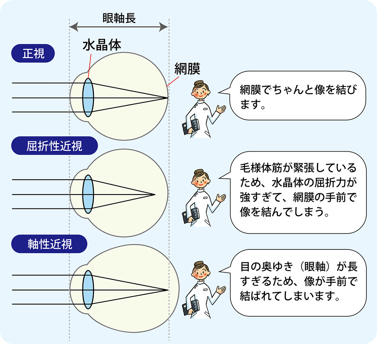 子供の目のトラブル…　正視・近視・遠視