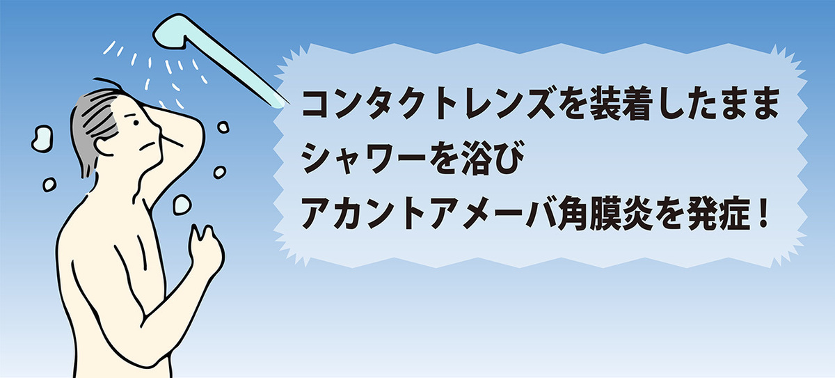 ルーズなコンタクト使用で、目に微生物“アメーバ”が繁殖!!