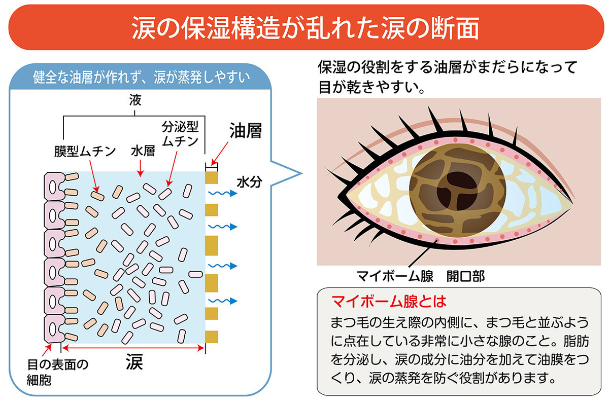 1日何度も目薬使っているのに良くならない。原因と対策は!