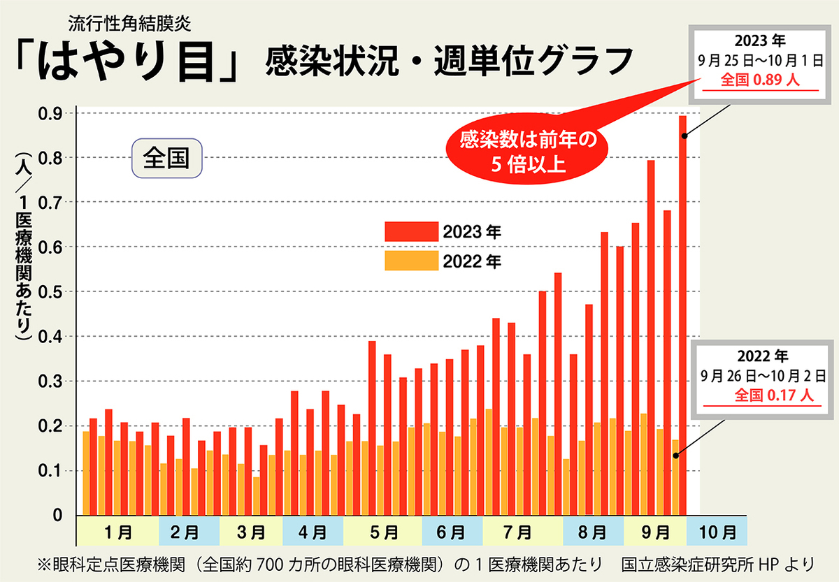 今年は、「はやり目」流行性角結膜炎の流行に要警戒!!