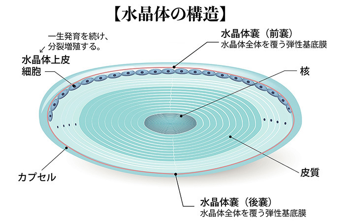 白内障を予防する方法。