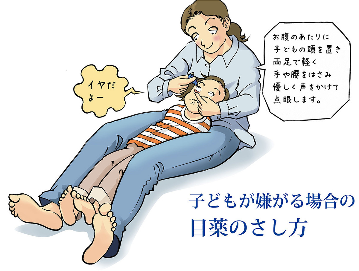 子どもへの目薬の上手なさし方をイラストで紹介