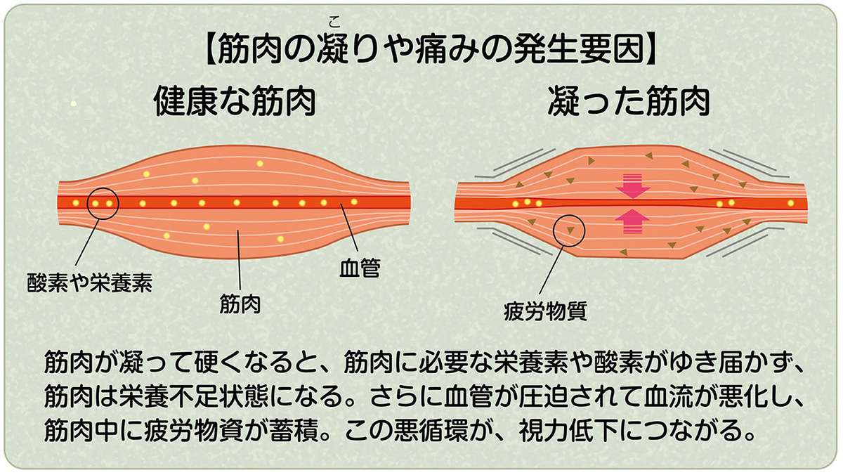 40歳から始まる目の老化。 目の老化を遅らせる視力トレーニング!