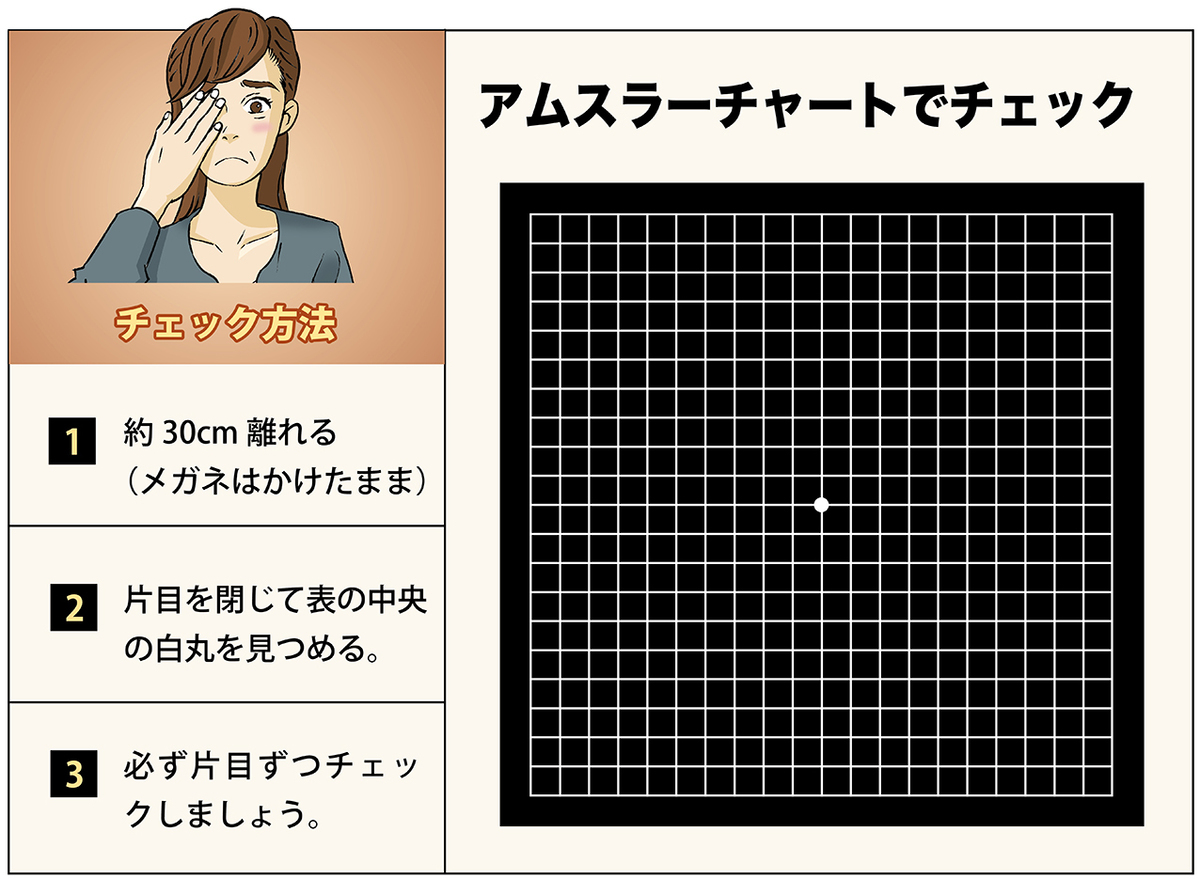 加齢黄斑変性_中高年の目の病気③