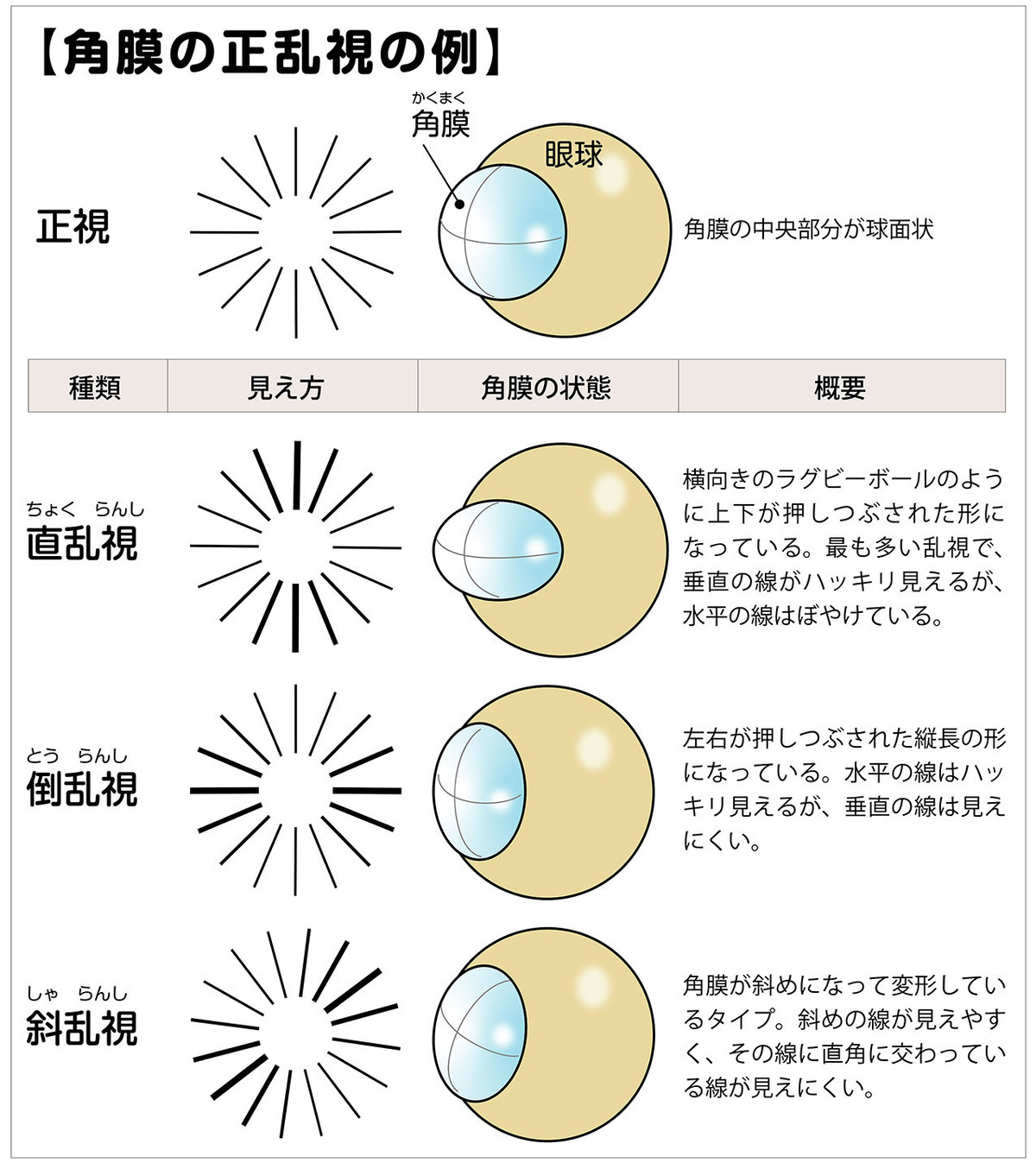 イラストで詳細に解説。乱視とは?