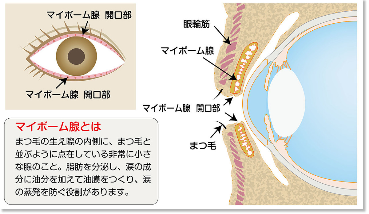 知識不足が目の障害を招く、コンタクトレンズ。